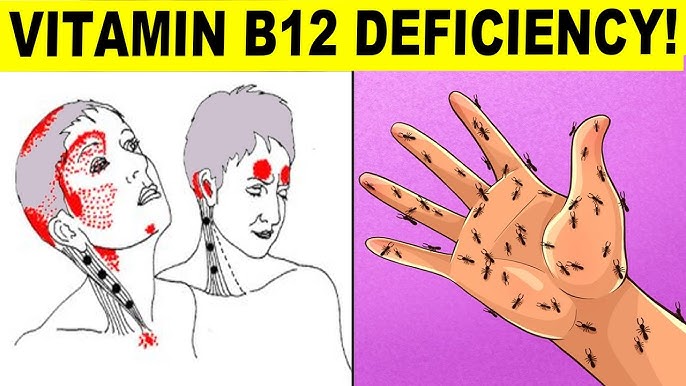 5 Warning Signs of Vitamin B12 Deficiency You Should Never Ignore